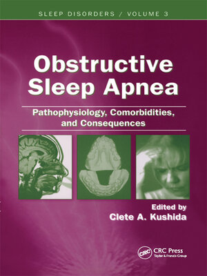 cover image of Obstructive Sleep Apnea
